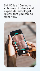 SkinIO guided check workflow on a phone