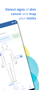 SkinVision body map / mole mapping screen